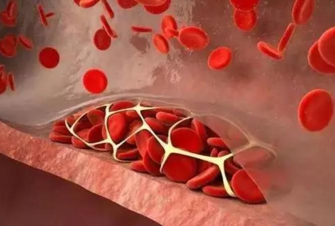 苹果可以帮助稳定甘油三酯水平